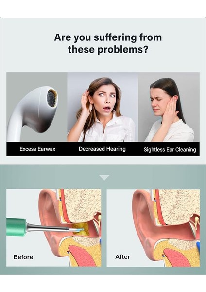 Bebırd T5 3mp Kamera 3.5mm Lens Şarjlı Wıfı Görüntülü Kulak Temizleyici Yeşil Renk fiyatları