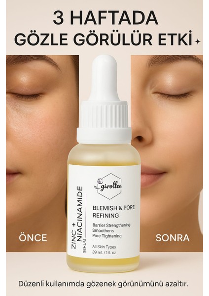Zinc + Niacinamide Serum 30 ml – Gözenek Sıkılaştırıcı, Sivilce ve Leke Karşıtı Serum fiyatları
