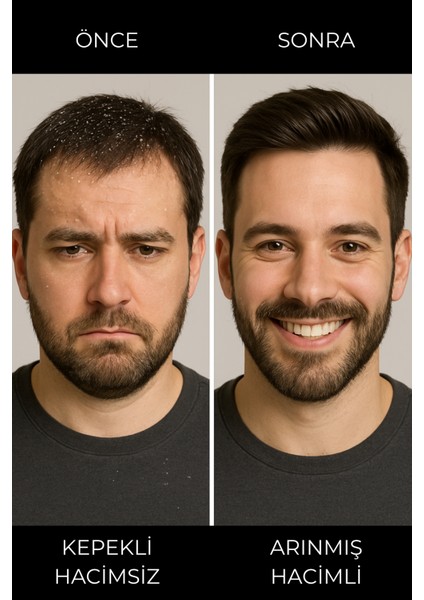 Erkekler Için Saç Güçlendirici ve Dökülme Karşıtı Profesyonel Şampuan 200 ml - Biotin & Keratin indirimleri