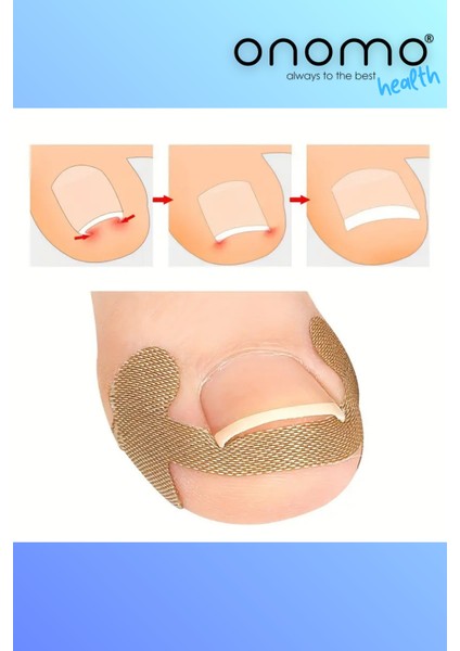 Health Batık Tırnak Düzeltme Bandı 20 Adet fiyatları