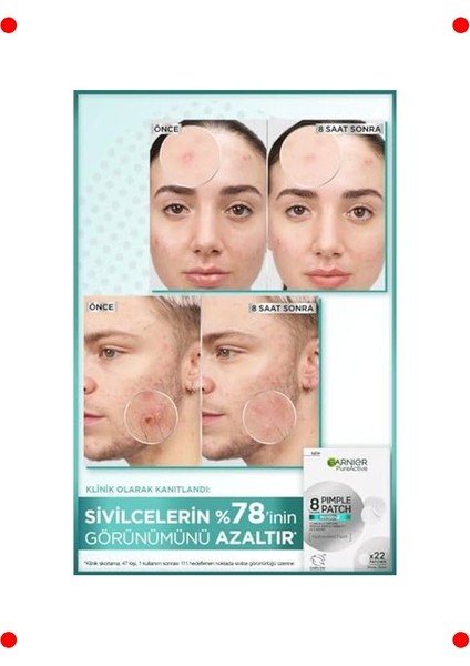 Hidrokolloid Sivilce Bandı Şeffaf 22 Adet fırsatları