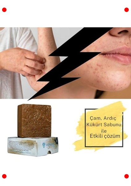 Çam Ardıç Kükürt Doğal Sabun - Egzama & Sivilceye Yönelik fırsatları