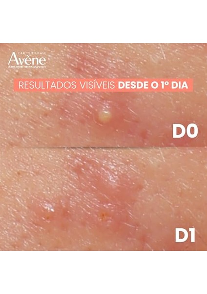 Cleanance Comedomed Cilt Peelingi 40 ml modelleri