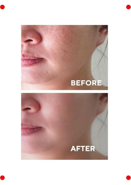 Aha Bha Kırmızı Peeling Cilt Serumu 30 ml modelleri