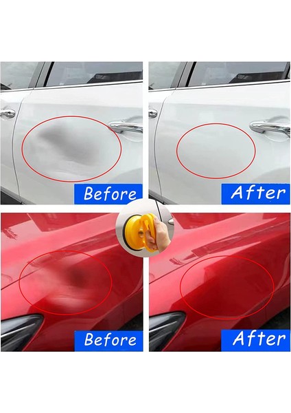 Göçük Sökücü, Araba Göçük Sökücü, 3'lü Göçük Sökme Seti Sap Kaldırıcı, Güçlü Araba Göçük Sökücü, Vakumlu Göçük Sökücü (Yurt Dışından) fırsatları