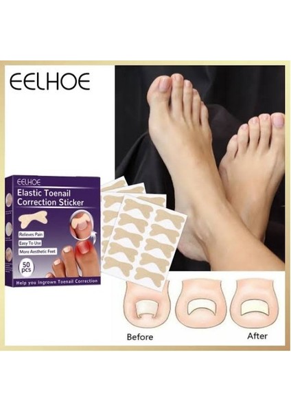 Ayak Tırnağı Düzeltme Bandı 50 Adet indirimleri