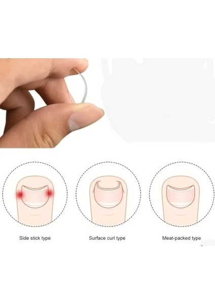 Batık Tırnak Düzeltici Aparat fiyatları