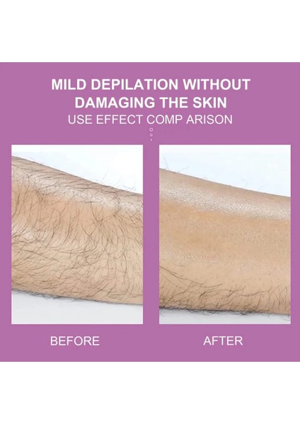 Epilatör Kristal Epilasyon Aleti fiyatları