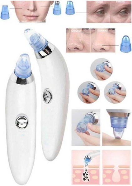 Vakumlu Siyah Nokta ve Yüz Temizleme Cihazı 4 Başlıklı - I90H02N9-5A69VS indirimleri