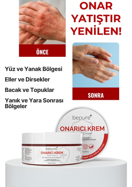 Hasar Görmüş Cilt Bariyer Onarıcı, Seramid, Madecassoside Destekli, Yoğun Onarıcı Krem 100 ml fırsatları