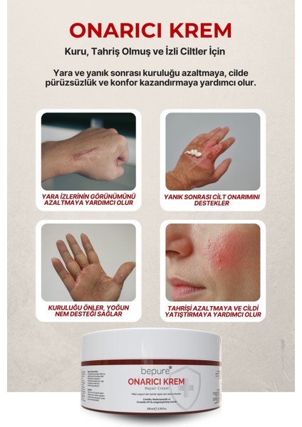 Hasar Görmüş Cilt Bariyer Onarıcı, Seramid, Madecassoside Destekli, Yoğun Onarıcı Krem 100 ml indirimleri