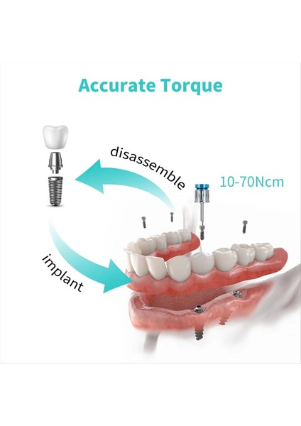 Diş Implantı Kiti, Protez Tork Anahtarı Tornavida Aracı (Yurt Dışından) indirimleri