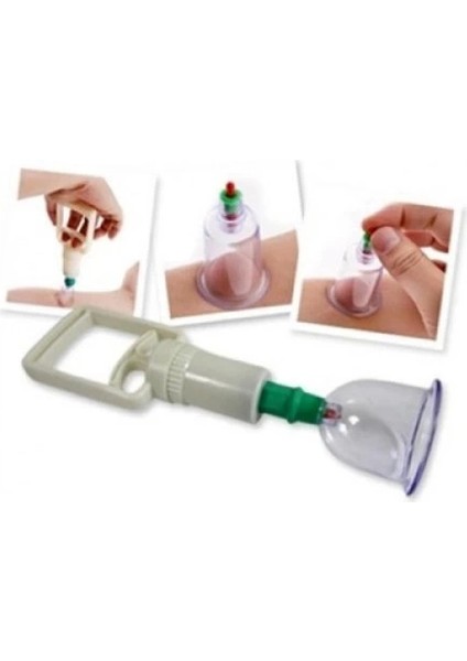 Buğz Kupa Çekme Hacamat Seti 6 Adet fırsatları