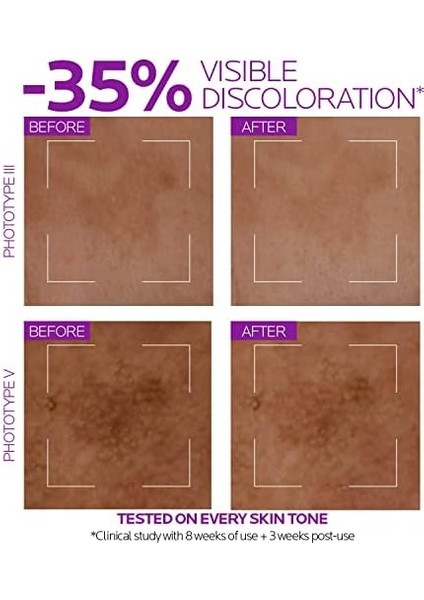 La Roche-Posay Niacinamide 10 Serum 30 ml