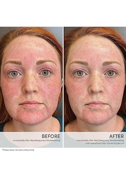 Jane Iredale Hydropure Color Correcting Serum modelleri