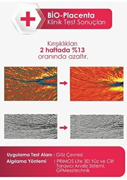 Cilt Serumu Aydınlatıcı Yaşlanma Karşıtı Leke Önleyici 30 ml C Vitamini İçerir