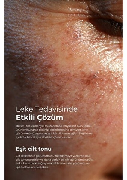 Tto Clinic Leke Kremi Leke Karşıtı Etkiyle 75 ml Arbutin ve Traneksamik Asit İçerir