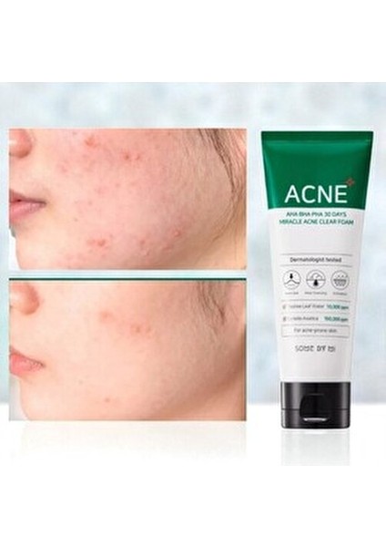 30 Günlük Etki Gösteren Yağlanma Karşıtı Köpük Krem 100 ml Kadınlar İçin