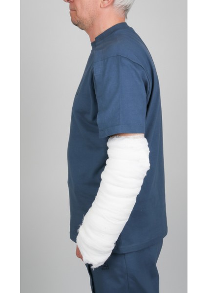 Adaptif Kısa Kollu Denim Mavi Kırık Kol - Ortopedi Tedavi Kıyafeti