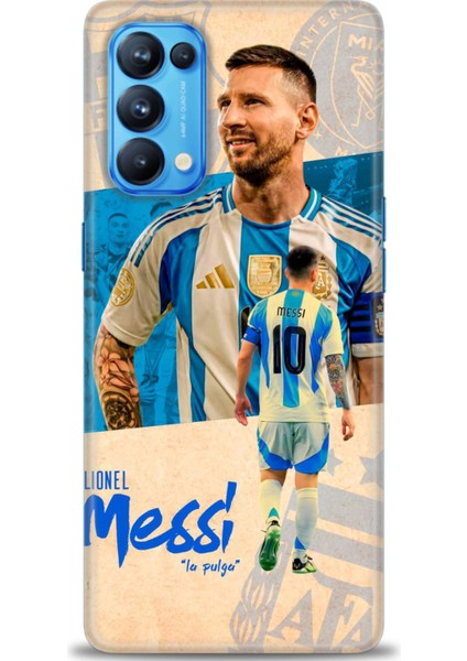 Oppo Reno 5 Pro Kılıf Hd Baskılı Kılıf + 9h Nano Tam Kaplayan Ekran Koruyucu 20