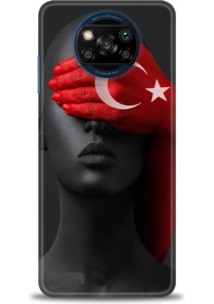 Xiaomi Poco X3 Pro Kılıf Hd Baskılı Kılıf + 9h Nano Tam Kaplayan Ekran Koruyucu 246