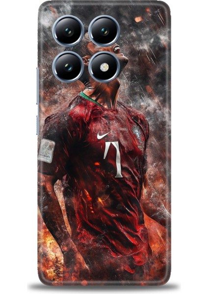 Xiaomi Mi 14T Pro Kılıf Hd Baskılı Kılıf + 9h Nano Tam Kaplayan Ekran Koruyucu 8