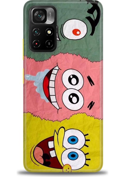 Xiaomi Poco M4 Pro 5g Kılıf Hd Baskılı Kılıf + 9h Nano Tam Kaplayan Ekran Koruyucu 460