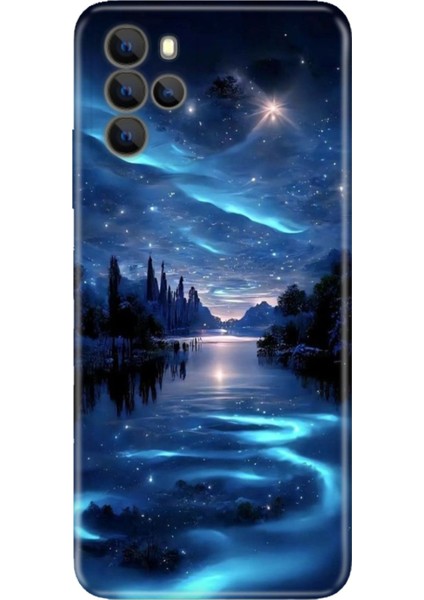 Omix X700 Uyumlu Kılıf Resimli Desenli Silikon Gece Yarısı