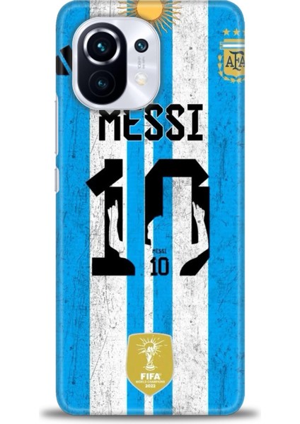 Xiaomi Mi 11 Kılıf Hd Baskılı Kılıf + 9h Nano Tam Kaplayan Ekran Koruyucu 18