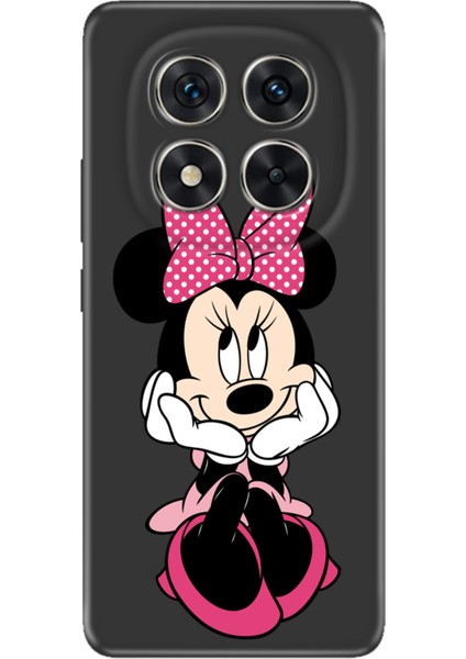 Xiaomi Redmi Note 15 Pro Plus+ 5g Kılıf Renkli Silikon Baskılı Tpu Minnie Karakter