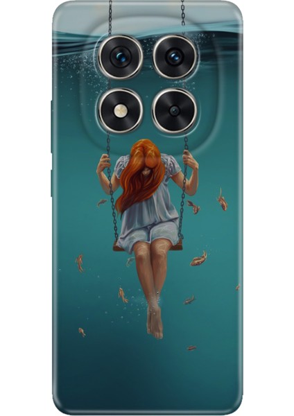 Xiaomi Redmi Note 15 Pro 5g Kılıf Renkli Silikon Baskılı Tpu Aşk Acısı