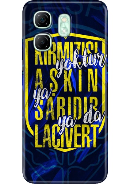 Infinix Hot 50I - Smart 9 Uyumlu Kılıf Desenli Tpu Silikon Baskılı Aşkın Rengi Sarı Lacivert