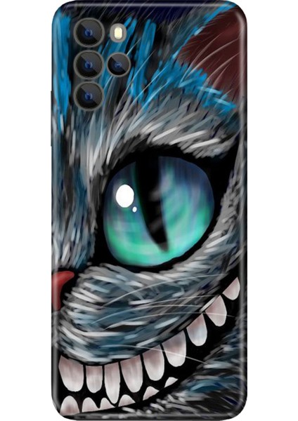 Omix X700 Kılıf Silikon Moderna Desenli Arsız Kedi