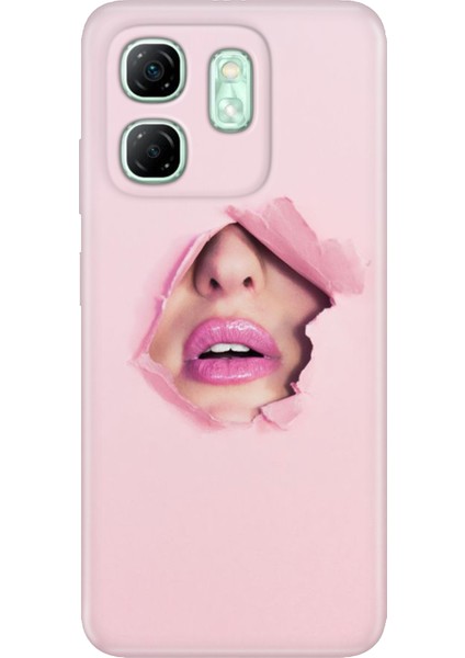 Infinix Hot 50I - Smart 9 Kılıf Desenli Tpu Silikon Saklı Aşk