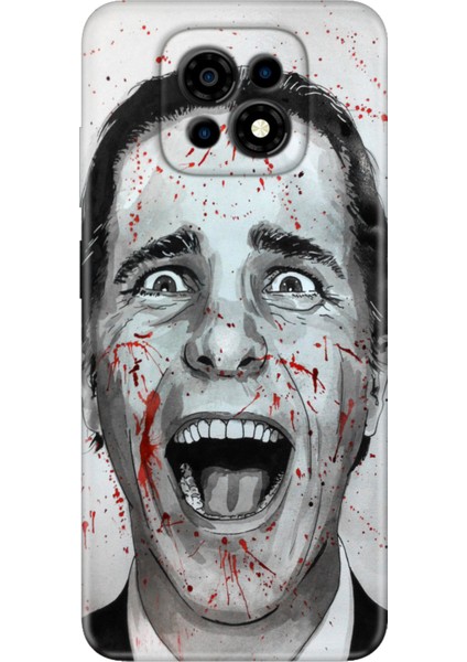 Casper Via M30 Kılıf Silikon Desenli VIAM30 Kapak American Psycho