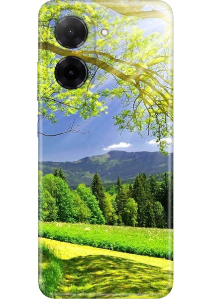 Xiaomi Redmi A5 Kılıf Dekoratif Silikon Baskılı Kapak Mis Oksijen