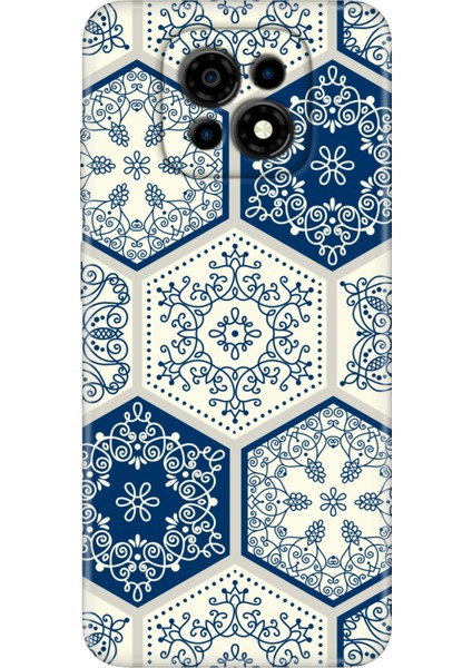 Casper Via M30 Kılıf Silikon Desenli VIAM30 Kapak Seramik