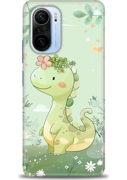 Xiaomi Mi 11I Kılıf Hd Baskılı Kılıf + 9h Nano Tam Kaplayan Ekran Koruyucu 302