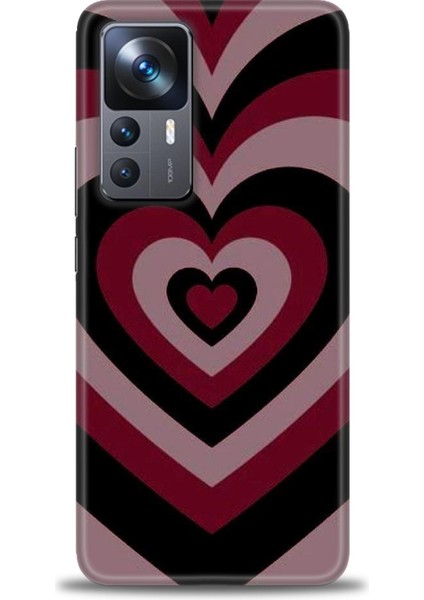 Xiaomi Mi 12T Kılıf Hd Baskılı Kılıf + 9h Nano Tam Kaplayan Ekran Koruyucu 191