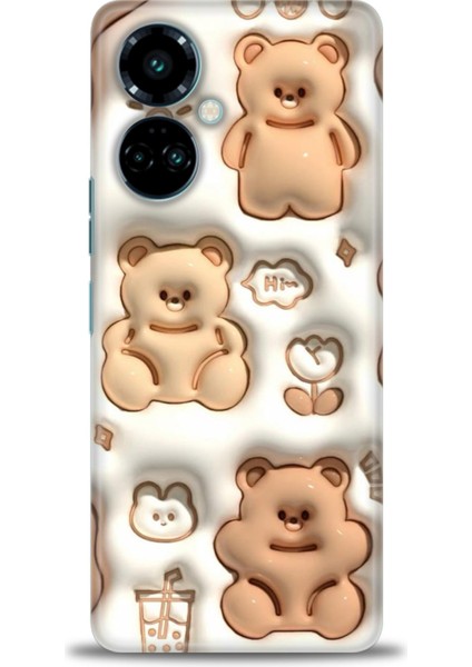 Tecno Camon 19 Pro Kılıf Hd Baskılı Kılıf + 9h Nano Tam Kaplayan Ekran Koruyucu 115