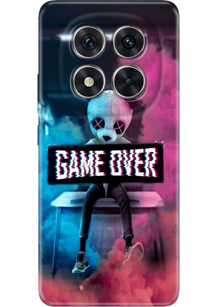 Xiaomi Redmi Note 15 Pro Plus+ 5g Kılıf Renkli Silikon Baskılı Tpu Game Over