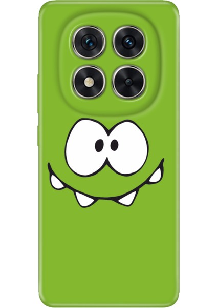 Xiaomi Redmi Note 15 Pro Plus+ 5g Kılıf Art Silikon Baskılı Tpu Şımarık