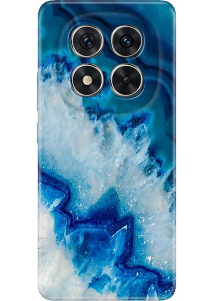 Xiaomi Redmi Note 15 Pro Plus+ 5g Kılıf Dekoratif Silikon Baskılı Kapak Koyu Ametist