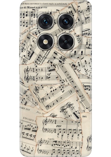 Xiaomi Redmi Note 15 Pro Plus+ 5g Kılıf Sonseri Silikon Baskılı Kapak Beste Nota