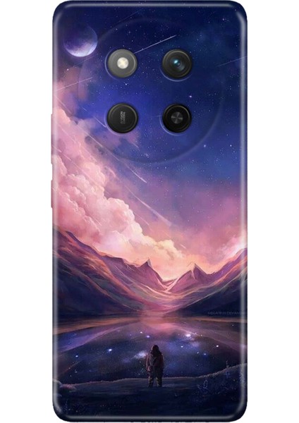 Honor X60 Pro - X9C 5g Kılıf Kapak Renkli Silikon Baskılı Tpu Mars Life