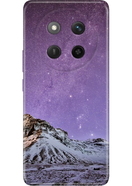 Honor X60 Pro - X9C 5g Kılıf Renkli Silikon Baskılı Tpu Parlak Manzara