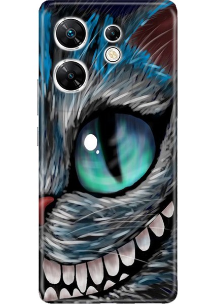 Infinix Zero 30 4g Kılıf Resimli Baskılı Nano Silikon Arsız Kedi