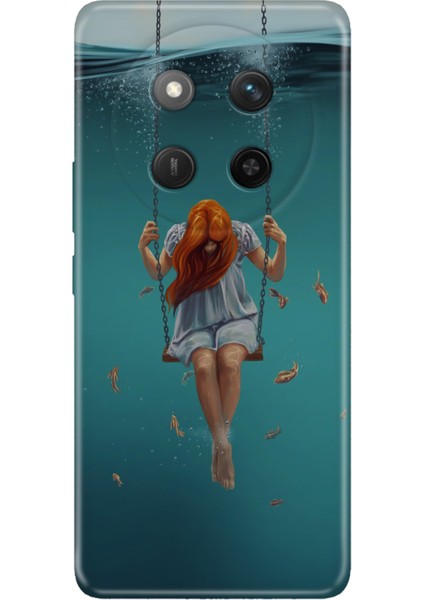 Honor X60 Pro - X9C 5g Kılıf Kapak Renkli Silikon Baskılı Tpu Aşk Acısı