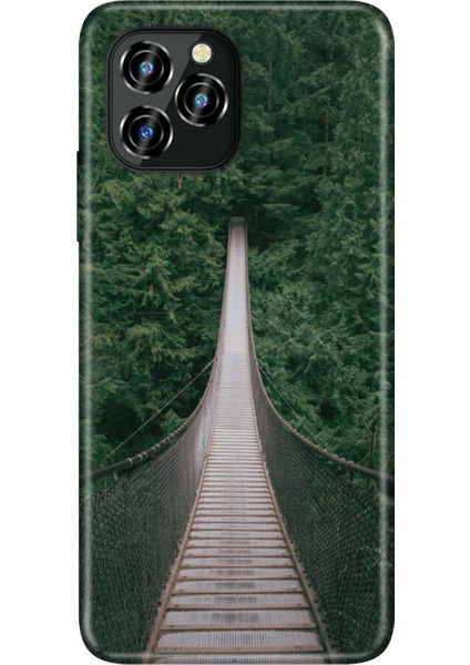 Oukitel C21 Pro Kılıf Silikon Desenli Resimli Uv Kapak Korku Köprüsü