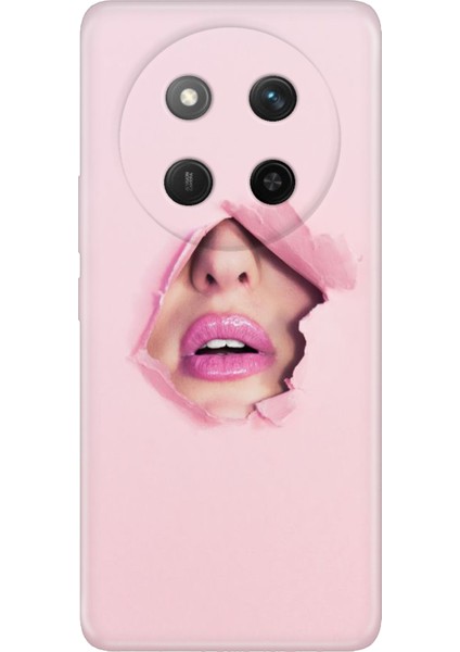 Honor X60 Pro - X9C 5g Kılıf Dekoratif Silikon Baskılı Kapak Saklı Aşk